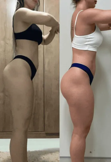 Antes e depois — Maria