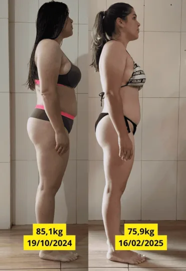 Antes e depois — Renata