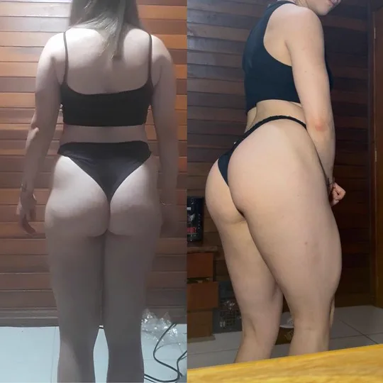 Antes e depois — Adrieli