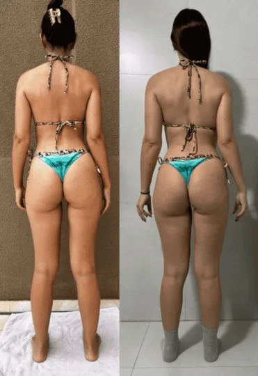 Antes e depois — Bruna
