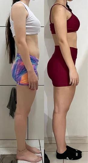 Antes e depois — Camila