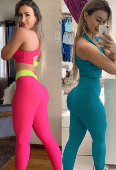 Antes e depois — Juliana