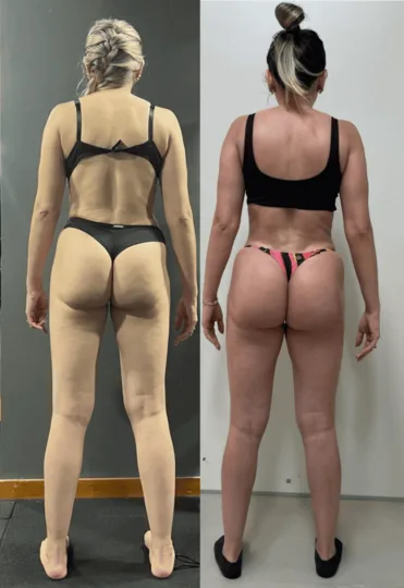 Antes e depois — Jessica